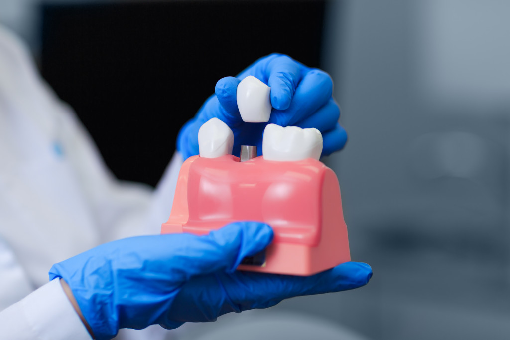 a close up photo of a doctor holding a teeth model with dental implant 